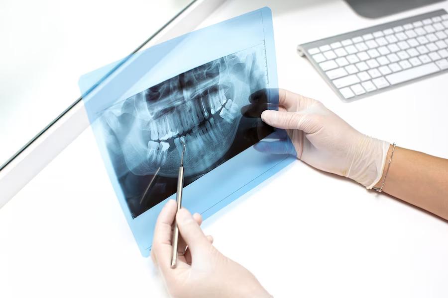 Что делают, если зубной имплантат не прижился?