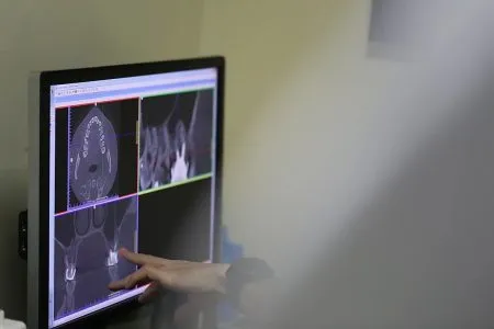 3D-компьютерное исследование в стоматологии