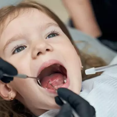 Whether milk teeth should be treated