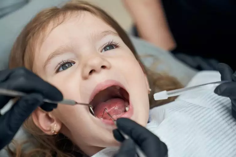 Whether milk teeth should be treated