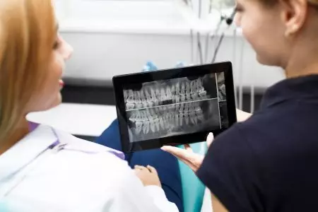 Dental CT scan
